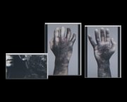 浣熊市综合征报告